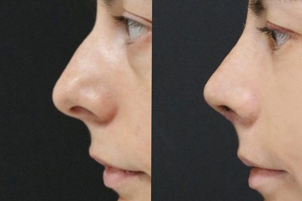 Jinsiy aloqa fotosuratlari Ilina bilan porno