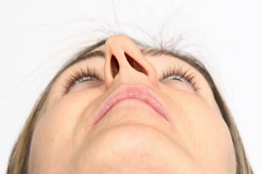 Burun Eğriliği Tedavisi