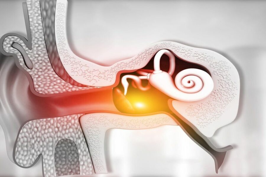 Orta Kulak Enfeksiyonu Tedavisi