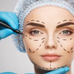 Yüz Cerrahisi Nedir?